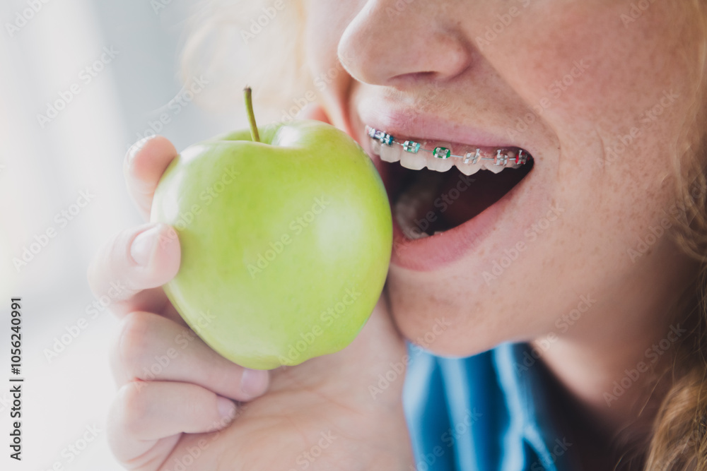 Cropped photo of nice young ginger girl bite apple eating teeth braces stomatology wear blue clothes Cropped photo of nice young ginger girl bite apple eating teeth braces stomatology wear blue clothes