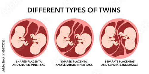 Different types of twins concept vector illustration on white background.