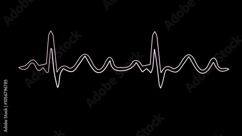 heart beat on monitor