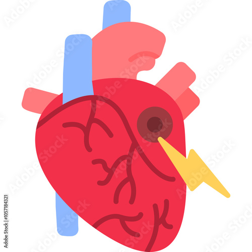 Stroke Icon