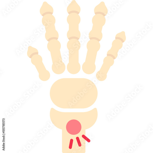 Carpal Tunnel Syndrome Icon