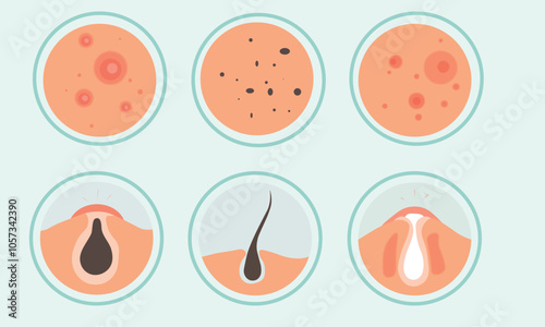 A set of icons of skin rashes and skin problems