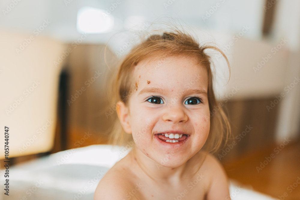 A cheerful child with messy hair and visible spots on the face smiles warmly at the camera, creating a joyful and lively atmosphere in the indoor setting. A cheerful child with messy hair and visible spots on the face smiles warmly at the camera, creating a joyful and lively atmosphere in the indoor setting.