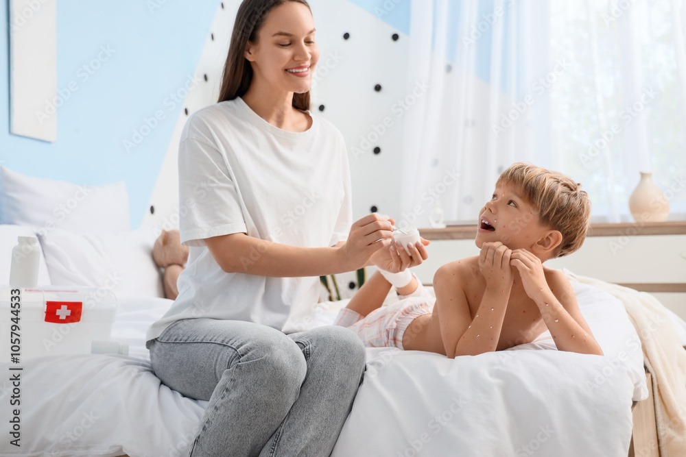 Mother smearing her little son ill with chickenpox in bedroom