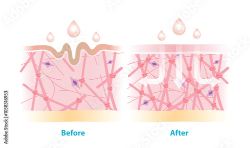 Before and after the skincare rejuvenate collagen and elastin in dermis vector illustration on white background. Cross section of wrinkles skin and skincare absorbing to help restore aging skin.