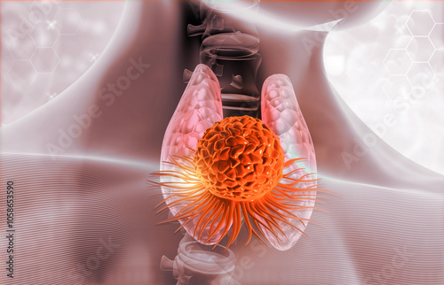 Human thyroid gland with cancer cells. 3d illustration. photo