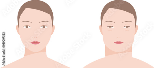 顔のむくみ、腫れがある女性の正面から見た顔のイラスト