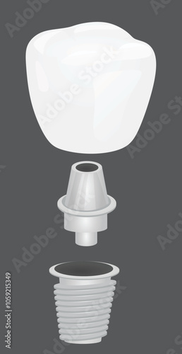 Dental implementation teeth. vector illustration