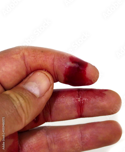 Obraz na płótnie Blood flowing from the cut on the hand after the knife accident w salonie