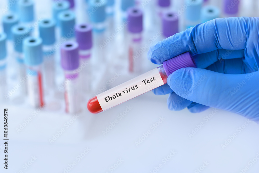 Doctor holding a test blood sample tube with Ebola virus test on the background of medical test tubes with analyzes. Doctor holding a test blood sample tube with Ebola virus test on the background of medical test tubes with analyzes.