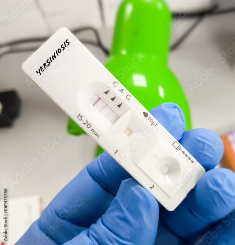 Stool sample Rapid test for Yersinia antigen test or Yersiniosis.Yersiniosis Culture Test. photo