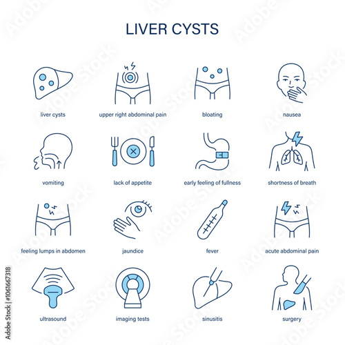 Liver Cysts symptoms, diagnostic and treatment vector icon set. Medical icons.