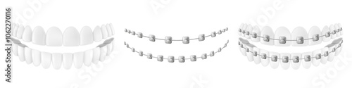 Teeth with or without braces isolated on white background. Arch braces without teeth. The concept of teeth alignment with braces. Orthodontic dentistry and treatment. Realistic 3d vector illustration