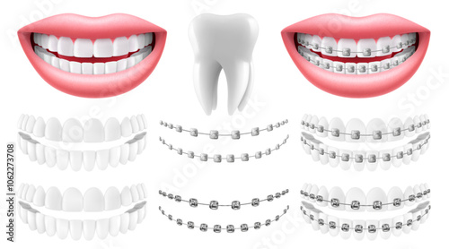 Teeth with or without braces. Arch braces without teeth. Orthodontic dentistry. The alignment of the teeth. Smile with white teeth and braces. Isolated realistic 3d vector