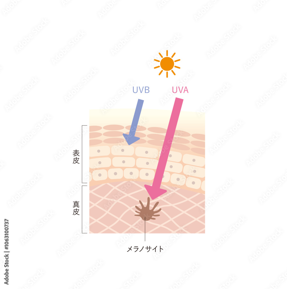 Фотография 図版_肌図版_017_紫外線の影響
