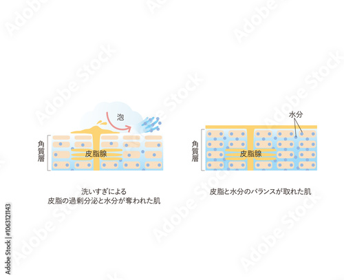 図版_肌図版_023_洗いすぎによる皮脂分泌