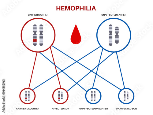 Hemophilia inheritance poster