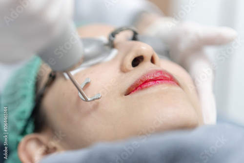 Woman receiving pico laser facial treatment in beauty Clinic.