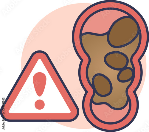 Illustration of constipation with a warning sign and blocked intestine.