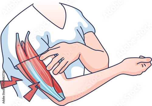 Illustration of arm muscle tension with highlighted muscles and pain indicators.