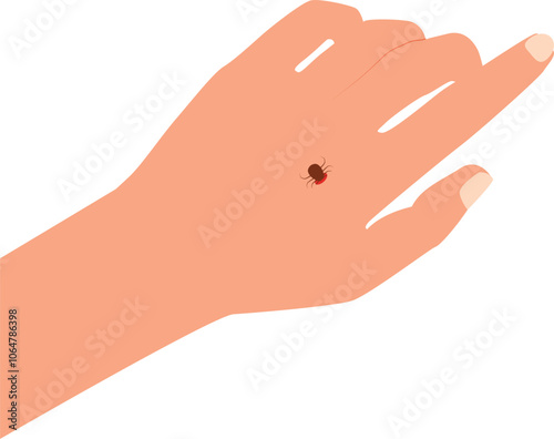 Tick ​​bite. Tick on a human's hand. Healthcare illustration. Vector illustration.