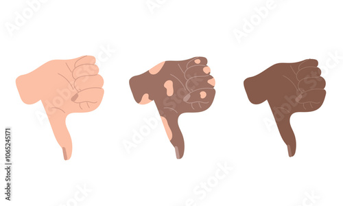 Thumb down gesture. White, dark and vitiligo skin hand. Concept of diversity, inclusivity. Hand drawn vector illustration in flat style. Disapprove icon, human arm, web banner