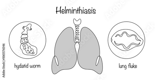 Helminthic infections of the lungs photo