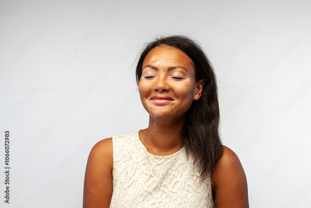 Happy female fashion model with eyes closed against gray background. Smiling young woman with vitiligo skin disease is wearing white dress. Happy female fashion model with eyes closed against gray background. Smiling young woman with vitiligo skin disease is wearing white dress.