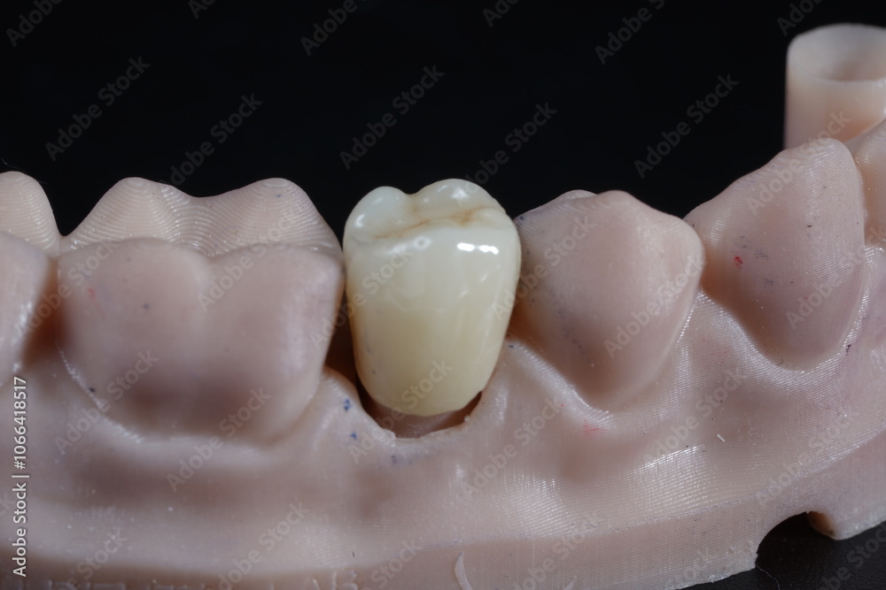 Fototapeta premium zirconia denture processing with dental digital cam/cad 