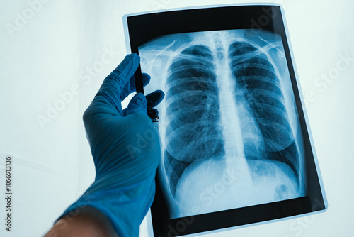 Xray Imaging of Human Lungs Conducted for Comprehensive Medical Analysis and Evaluation