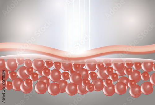 The laser penetrates the layers of the skin to repair wrinkles and reduce sagging skin cells.