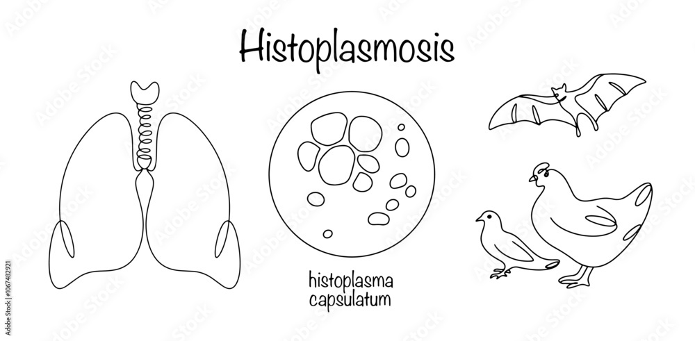 Histoplasmosis Histoplasmosis