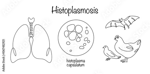 Histoplasmosis