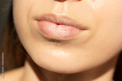 Fotografi Concept of lip basting