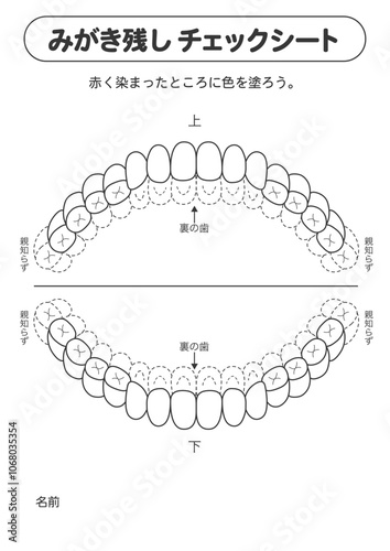 永久歯列期の磨き残しチェックシート　染め出しイラスト