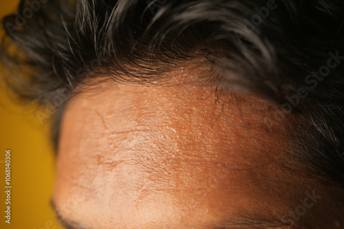 closeup of sweat on forehead against dark background ,