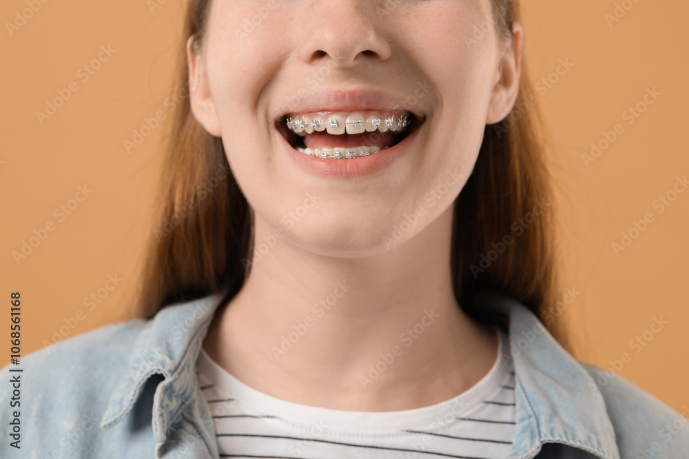 Girl with braces on beige background, closeup Girl with braces on beige background, closeup