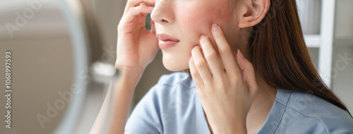 Fotografía Sensitive skin with cosmetology, Asian young woman looking at red spot on her face from cosmetic allergy in the mirror