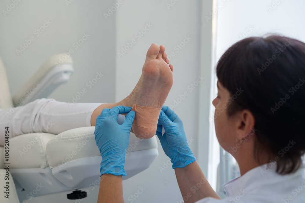 Fototapeta premium A podologist wearing gloves glues a special relief corn patch on the heel of the patient. Patient on medical pedicure procedure, visiting podiatrist. Peeling feet. Foot treatment in SPA salon.Podiatry