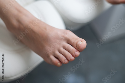 The patient's foot without manicure on the podologist's chair. Patient on medical pedicure procedure, visiting podiatrist. Peeling feet. Foot treatment in SPA salon.Podiatry clinic