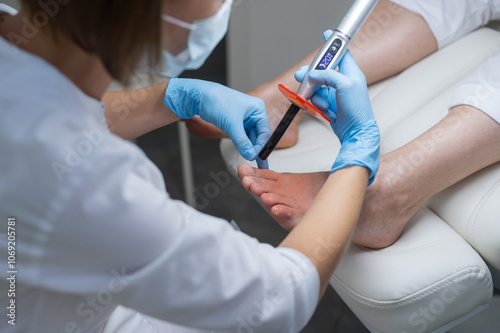 Рodologist in gloves puts a titanium thread on a toenail with special polymerization ultraviolet lamp. Patient on medical pedicure procedure, visiting podiatrist. Peeling feet. Foot treatment in SPA s photo