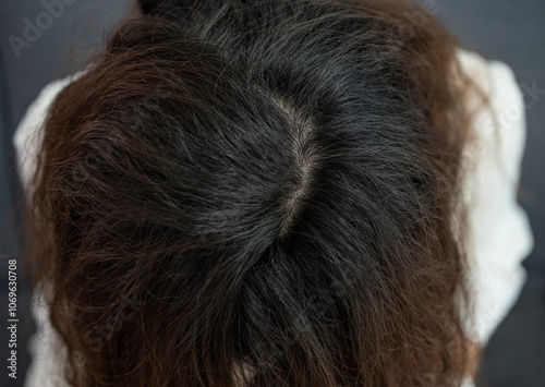 High angle view of thin hair spot on Asian woman head. Female pattern hair loss can progress from a widening part to overall thinning.