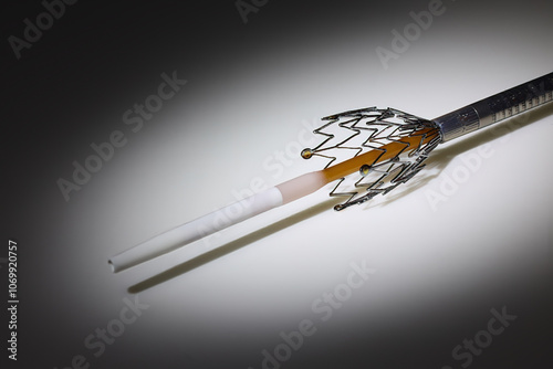 Freisetzung eines selbstexpandierbaren Stents, Metallgitter, Gefässstütze photo