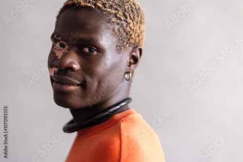 A close-up portrait of a man with vitiligo, wearing an orange sweatshirt and accessorized with a necklace and earrings