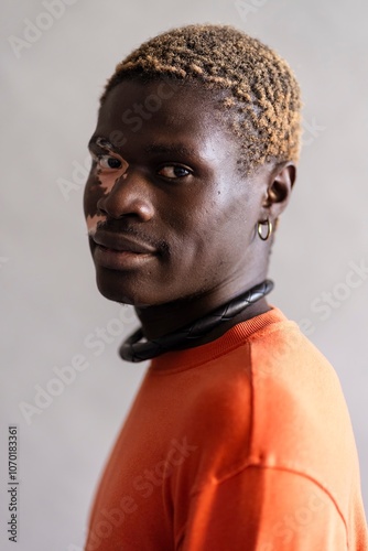 A close-up portrait of a man with vitiligo, wearing an orange sweatshirt and accessorized with a necklace and earrings