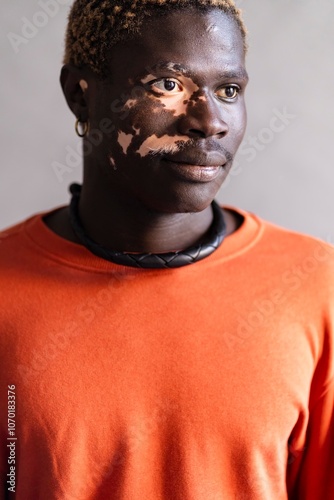 A close-up portrait of a man with vitiligo, wearing an orange sweatshirt and accessorized with a necklace and earrings