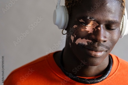 A close-up of a man with vitiligo, wearing an orange sweatshirt and headphones, with his eyes closed in a serene expression, fully absorbed in the music photo