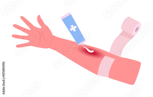 Cartoon injured hand. First aid for body skin burn, medical treatment for arm injury flat vector illustration. Injured human hand and medical treatment