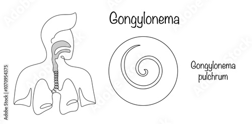 Gongylonema