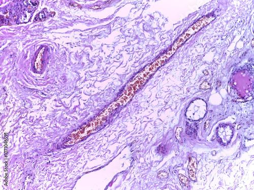 Microscopic Tissue Analysis with Purple Staining